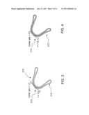 TWIST-AXLE WITH LONGITUDINALLY-VARYING WALL THICKNESS diagram and image