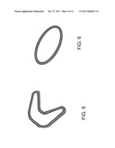 TWIST-AXLE WITH LONGITUDINALLY-VARYING WALL THICKNESS diagram and image