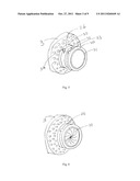 APICAL ACCESS AND CONTROL DEVICES diagram and image