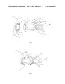 APICAL ACCESS AND CONTROL DEVICES diagram and image