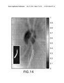 LENSLET ARRAY FOR RETINAL OXIMETRY diagram and image