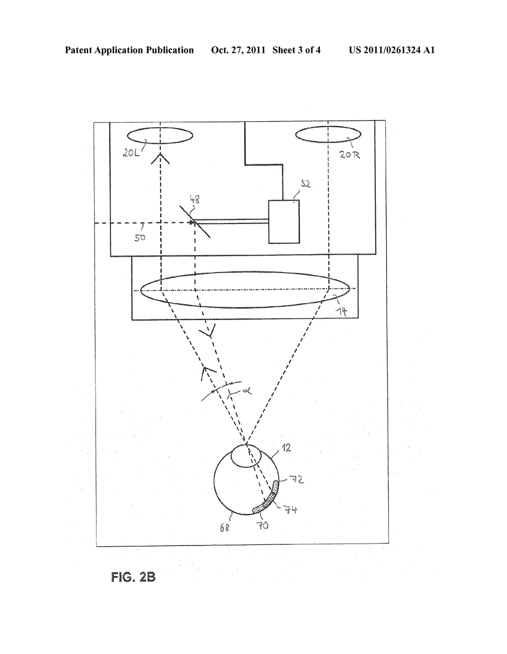 Illumination System for an Ophthalmic Surgical Microscope, Ophthalmic     Surgical Microscope, and Method for Operating an Illumination System for     an Ophthalmic Surgical Microscope - diagram, schematic, and image 04