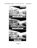 SYSTEMS, METHODS AND COMPUTER-ACCESSIBLE MEDIUM WHICH PROVIDE MICROSCOPIC     IMAGES OF AT LEAST ONE ANATOMICAL STRUCTURE AT A PARTICULAR RESOLUTION diagram and image