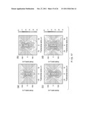 SYSTEMS, METHODS AND COMPUTER-ACCESSIBLE MEDIUM WHICH PROVIDE MICROSCOPIC     IMAGES OF AT LEAST ONE ANATOMICAL STRUCTURE AT A PARTICULAR RESOLUTION diagram and image