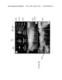 SYSTEMS, METHODS AND COMPUTER-ACCESSIBLE MEDIUM WHICH PROVIDE MICROSCOPIC     IMAGES OF AT LEAST ONE ANATOMICAL STRUCTURE AT A PARTICULAR RESOLUTION diagram and image