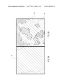 ABNORMAL SKIN AREA CALCULATING SYSTEM AND CALCULATING METHOD THEREOF diagram and image