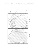 ABNORMAL SKIN AREA CALCULATING SYSTEM AND CALCULATING METHOD THEREOF diagram and image