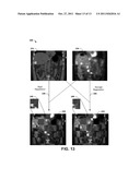 COMPOSITE IMAGES FOR MEDICAL PROCEDURES diagram and image