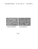 USE OF INTERLEUKIN-22 IN THE TREATMENT OF FATTY LIVER DISEASE diagram and image