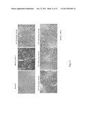 USE OF INTERLEUKIN-22 IN THE TREATMENT OF FATTY LIVER DISEASE diagram and image