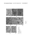 USE OF INTERLEUKIN-22 IN THE TREATMENT OF FATTY LIVER DISEASE diagram and image