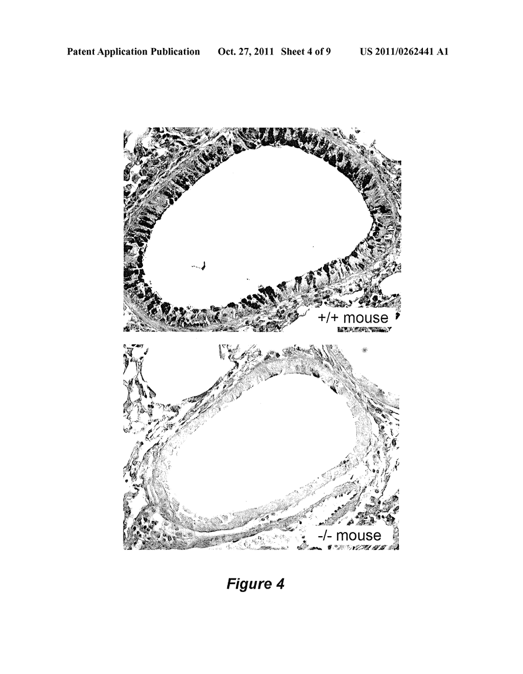 METHOD FOR SELECTIVE CONTROL OF HELPER T CELL FUNCTION - diagram, schematic, and image 05