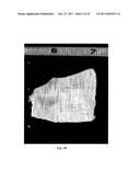 FENESTRATED WOUND REPAIR SCAFFOLD diagram and image