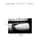 FENESTRATED WOUND REPAIR SCAFFOLD diagram and image