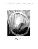 FENESTRATED WOUND REPAIR SCAFFOLD diagram and image