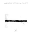 FENESTRATED WOUND REPAIR SCAFFOLD diagram and image