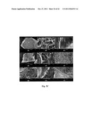 FENESTRATED WOUND REPAIR SCAFFOLD diagram and image