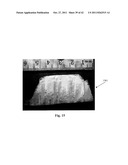 FENESTRATED WOUND REPAIR SCAFFOLD diagram and image