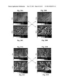 FENESTRATED WOUND REPAIR SCAFFOLD diagram and image