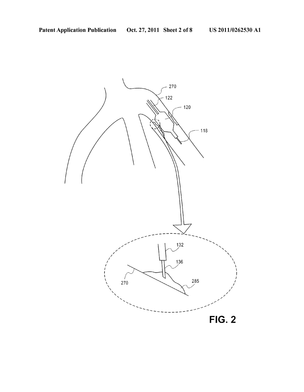 SUSTAINED RELEASE OF APO A-I MIMETIC PEPTIDES AND METHODS OF TREATMENT - diagram, schematic, and image 03