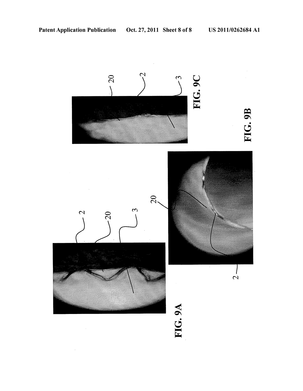 IMPLANT AND METHOD FOR PRODUCING THE SAME - diagram, schematic, and image 09