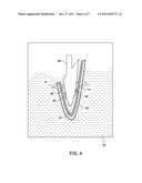 METHOD FOR ROUGHENING METAL SURFACES AND ARTICLE MANUFACTURED THEREBY diagram and image