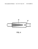 METHOD FOR FILTERING AND TREATING DENTAL SOLID WASTE diagram and image