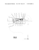 DENTAL APPLIANCE FOR CONSTRAINING THE TONGUE diagram and image