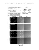 PLATELET ANALYSIS diagram and image