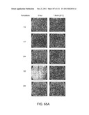 LOWER DOSAGE STRENGTH PHARMACEUTICAL COMPOSITIONS FORMULATED WITH 2.5%     IMIQUIMOD diagram and image