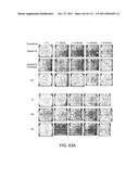 METHOD OF TREATING ACTINIC KERATOSIS WITH 3.75% IMIQUIMOD CREAM diagram and image