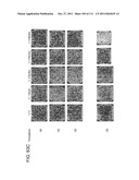 METHOD OF TREATING ACTINIC KERATOSIS WITH 3.75% IMIQUIMOD CREAM diagram and image