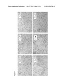 ANTROCIN CONTAINING PHARMACEUTICAL COMPOSITIONS FOR INHIBITING CANCER     CELLS diagram and image