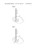 METHOD, DEVICE AND APPARATUS SYSTEM FOR PROSTATE CANCER THERAPY diagram and image