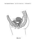 MEDICAL SLINGS diagram and image