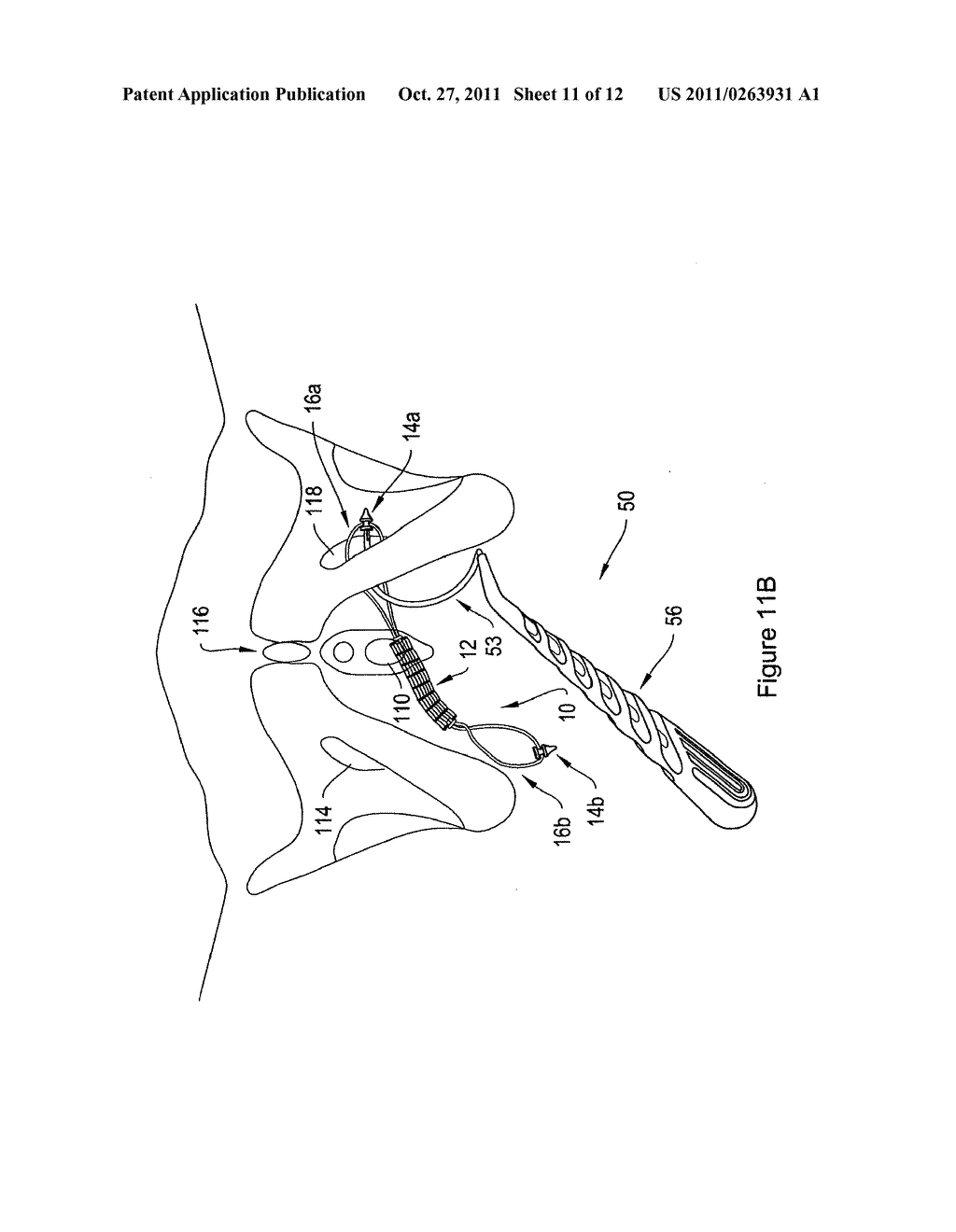 ELASTIC SLING SYSTEM AND RELATED METHODS - diagram, schematic, and image 12