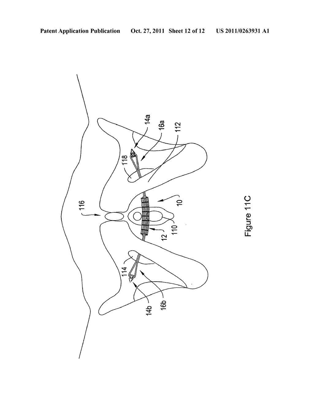 ELASTIC SLING SYSTEM AND RELATED METHODS - diagram, schematic, and image 13