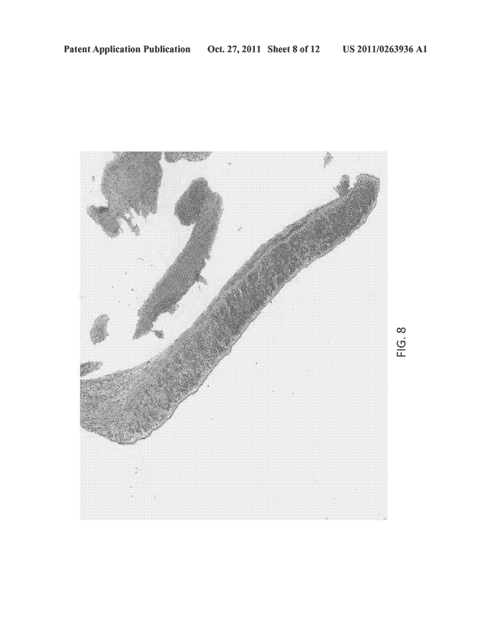 DEVICES AND METHODS FOR PREDICTING AND PREVENTING RESTENOSIS - diagram, schematic, and image 09