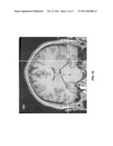 Drug-Enhanced Neurofeedback diagram and image