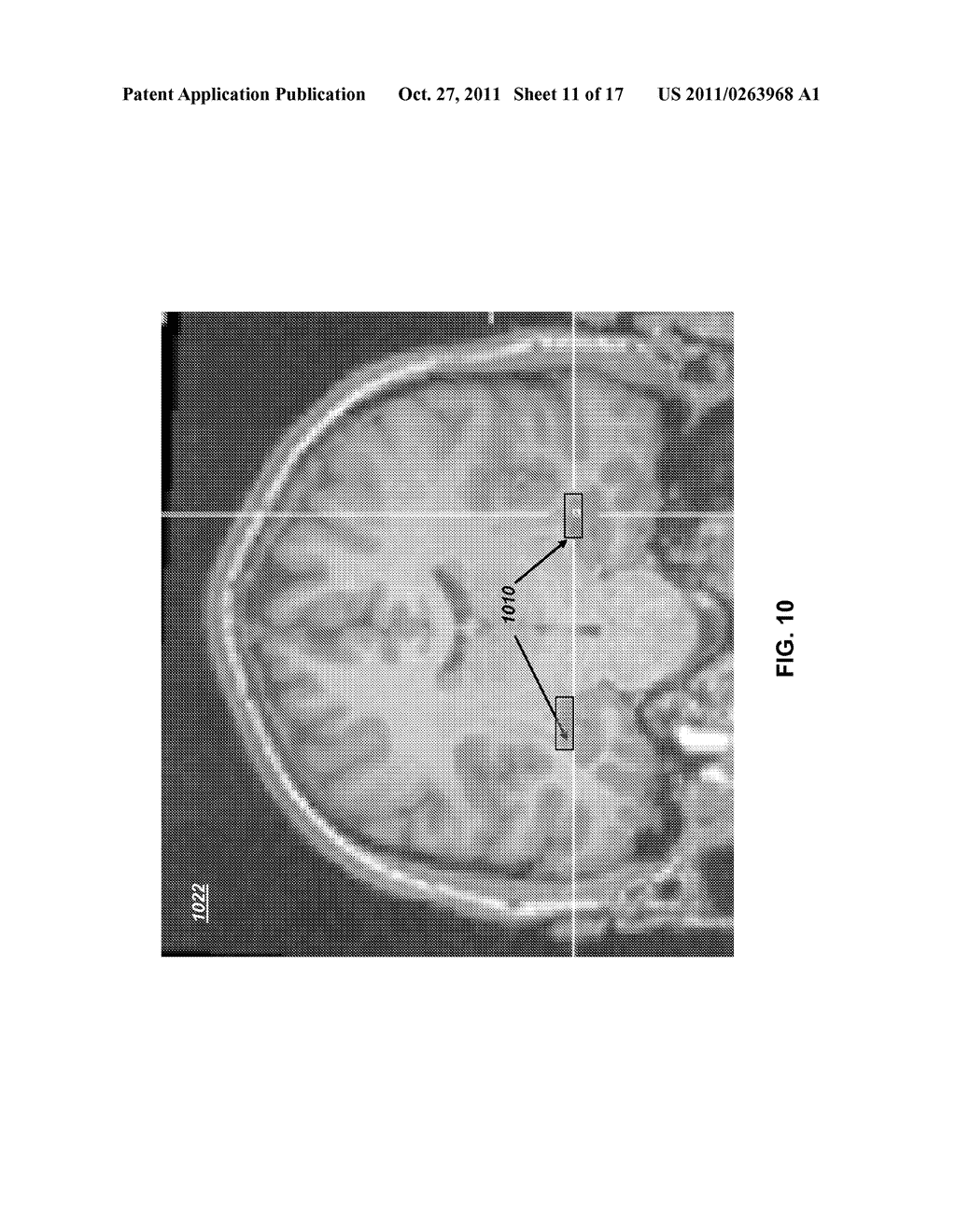 Drug-Enhanced Neurofeedback - diagram, schematic, and image 12