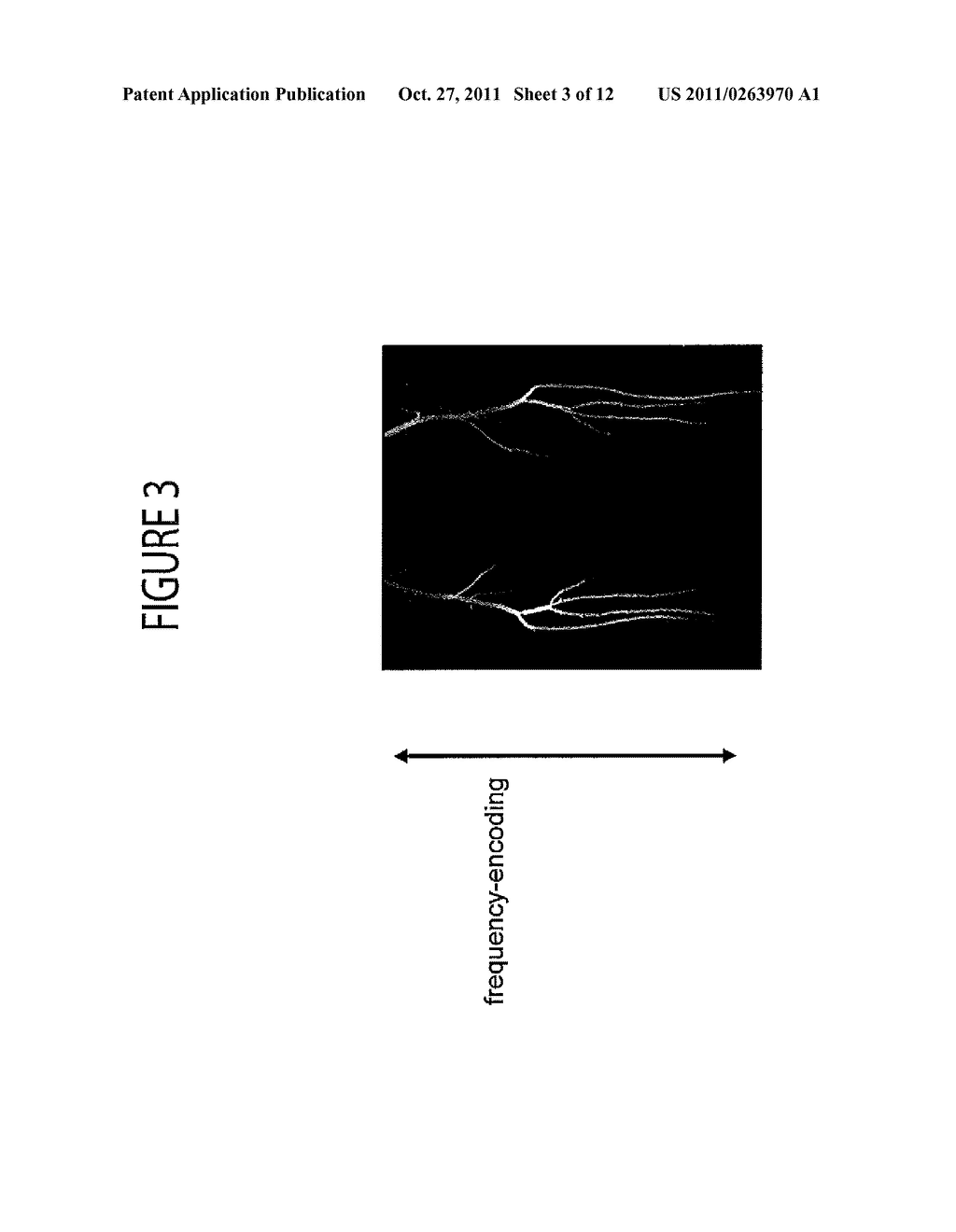 System for Non-Contrast Enhanced MR Anatomical Imaging - diagram, schematic, and image 04