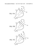 METHOD FOR PRESSURE MEDIATED SELECTIVE DELIVERY OF THERAPEUTIC SUBSTANCES     AND CANNULA diagram and image