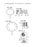 METHOD FOR PRESSURE MEDIATED SELECTIVE DELIVERY OF THERAPEUTIC SUBSTANCES     AND CANNULA diagram and image