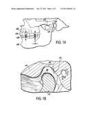 PHYSICAL REHABILITATION AND TRAINING AID: METHOD OF USING MUSCULOSKELETAL     REPOSITIONING DEVICE diagram and image