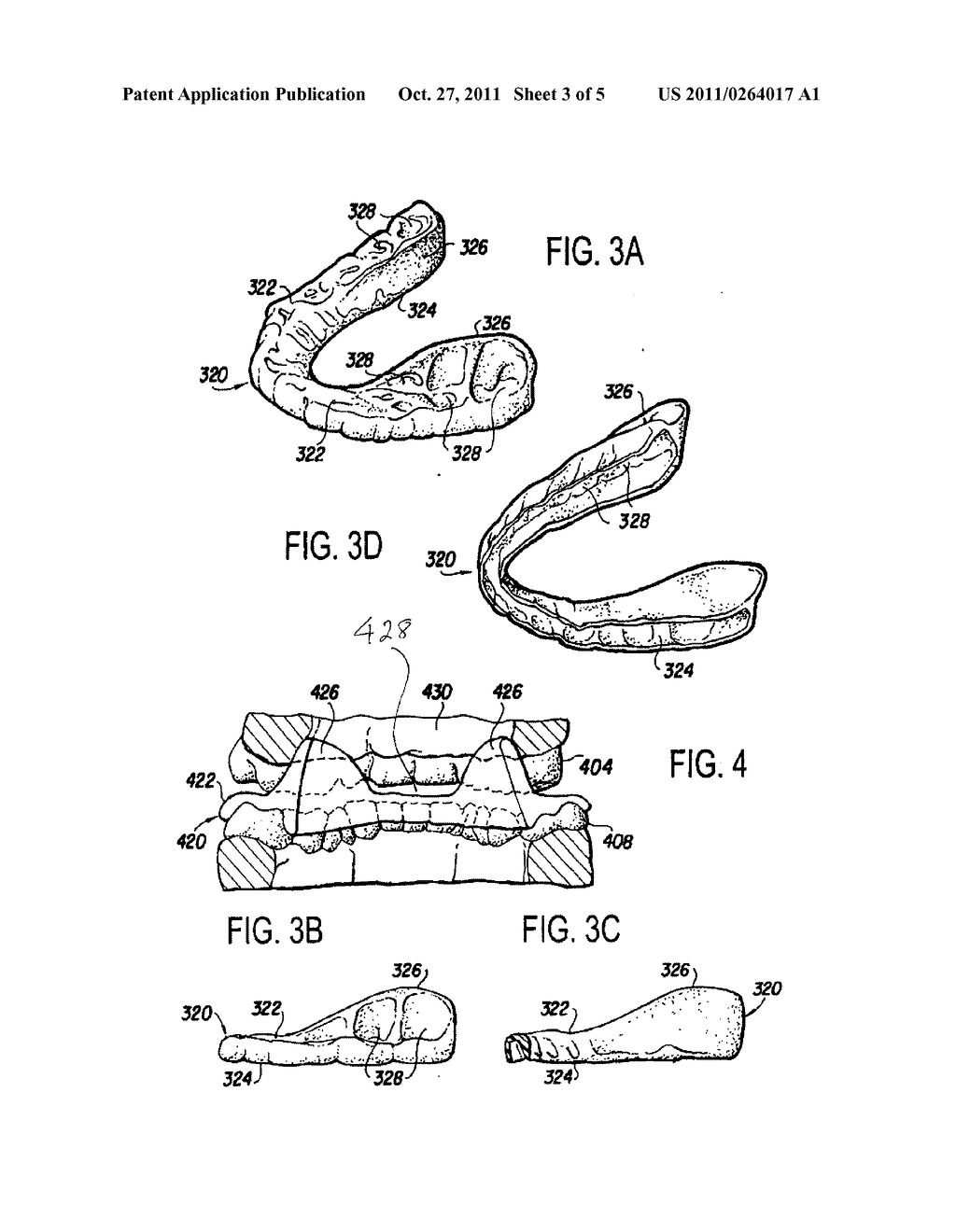 PHYSICAL REHABILITATION AND TRAINING AID: METHOD OF USING MUSCULOSKELETAL     REPOSITIONING DEVICE - diagram, schematic, and image 04