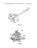 PHYSICAL REHABILITATION AND TRAINING AID: METHOD OF USING MUSCULOSKELETAL     REPOSITIONING DEVICE diagram and image