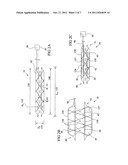 Expandable perfusion balloon diagram and image