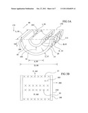 Expandable perfusion balloon diagram and image