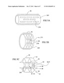 Expandable perfusion balloon diagram and image