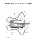 STABILIZATION DEVICE diagram and image